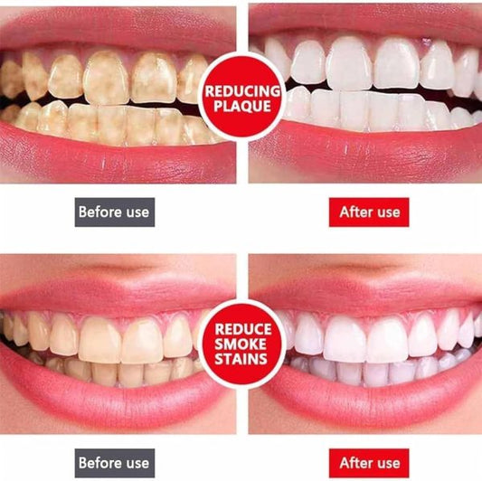 Yayashi Sp-4 Ultra Whitening Toothpaste Probiotic Stain Remover Stain Removing Toothpaste, Protects Gums Freshens Breath, For Everyone – 120 Gram